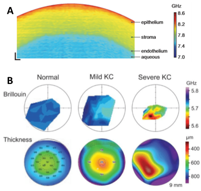 Brillouin Microscopy_images-2.png