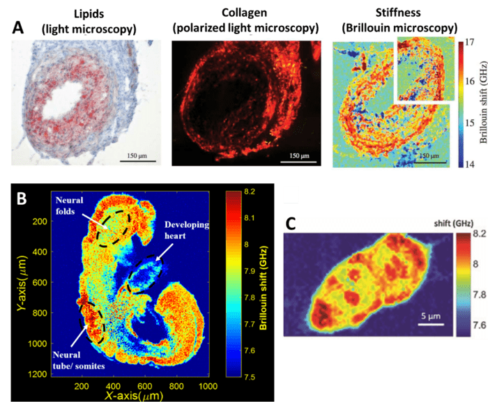 Brillouin Microscopy_images-4.png