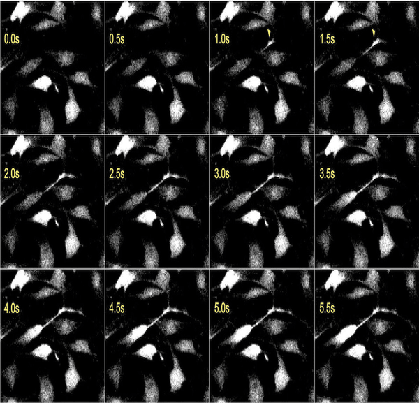 Calcium Imaging at Medical University of Vienna | Teledyne Vision Solutions