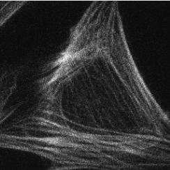 Confocal STORM_images-2.png