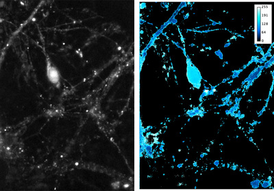 FRET-Imaging-Humboldt-University-Berlin (1).jpg