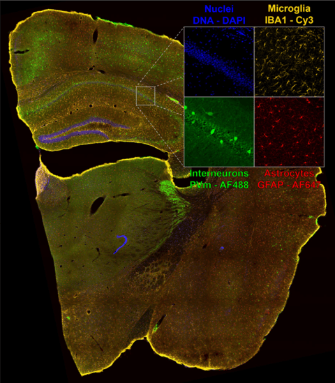 High-Throughput Spinning Disk Confocal 2.png