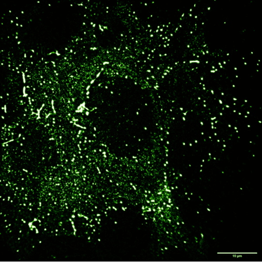 Imaging Live Cell Exocytosis_image_1.png