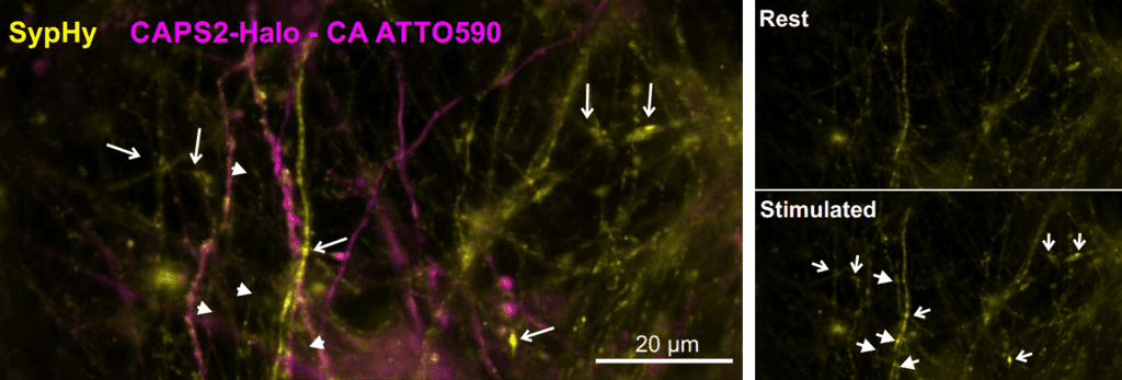 Imaging Live Cell Exocytosis_image_01.png