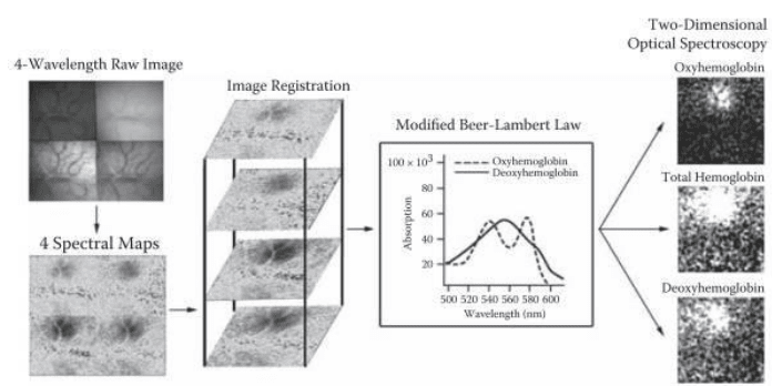 Intrinsic Signal Optical Imaging_image_02.png