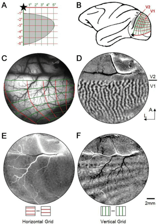 Intrinsic Signal Optical Imaging_image_03.png