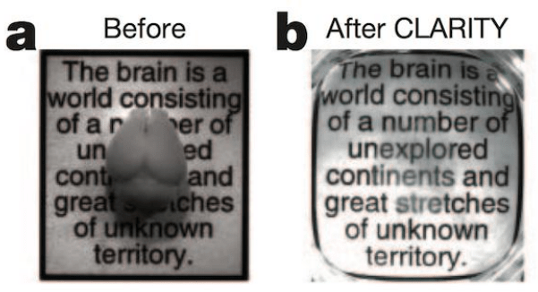 Introduction To Light Sheet Microscopy_images-6.png