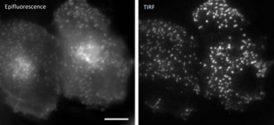 Epi-vs-TIRF-768x351 (1).png