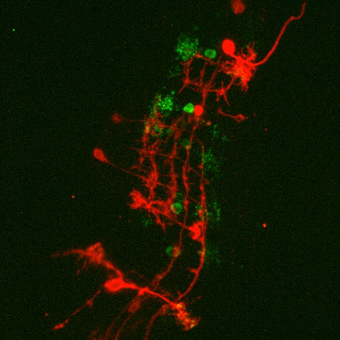 Live-Cell-Spinning-Disk-Heidelberg.png