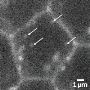 Live Vesicle Trafficking | Teledyne Vision Solutions