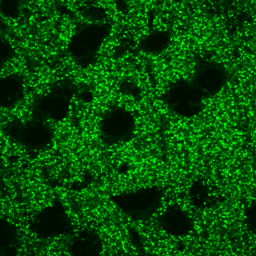 Maximizing Data Throughput in Spinning Disk Confocal_image_1.png