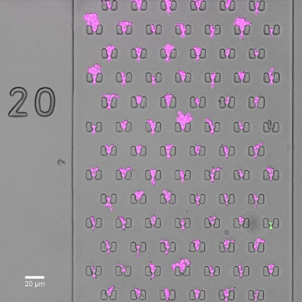 Microfluidic Live Yeast Imaging-image_1.jpg