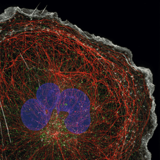 Modernizing Spinning Disk Confocal Microscopy_image_2.png