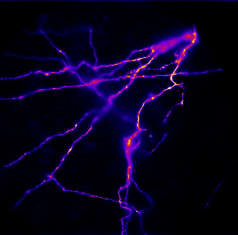 Overcoming The Challenges Of High Speed Voltage Imaging_image_3.png