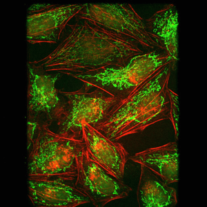 Spinning Disk Confocal_images_1.png