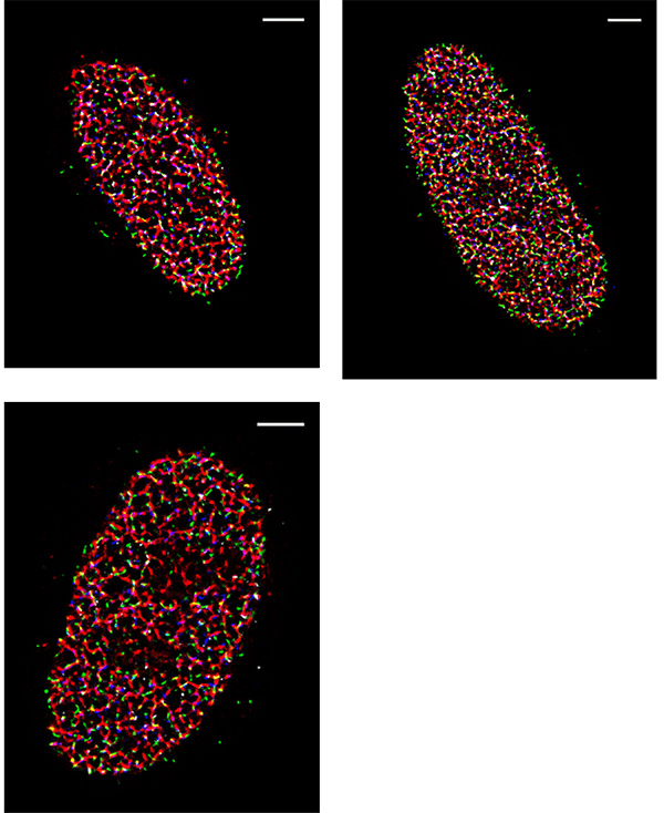 STORM-Super-Resolution-New-York-University.png