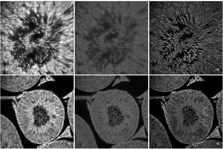 Structured-llumination-Microscopy-University-of-Colorado.jpg