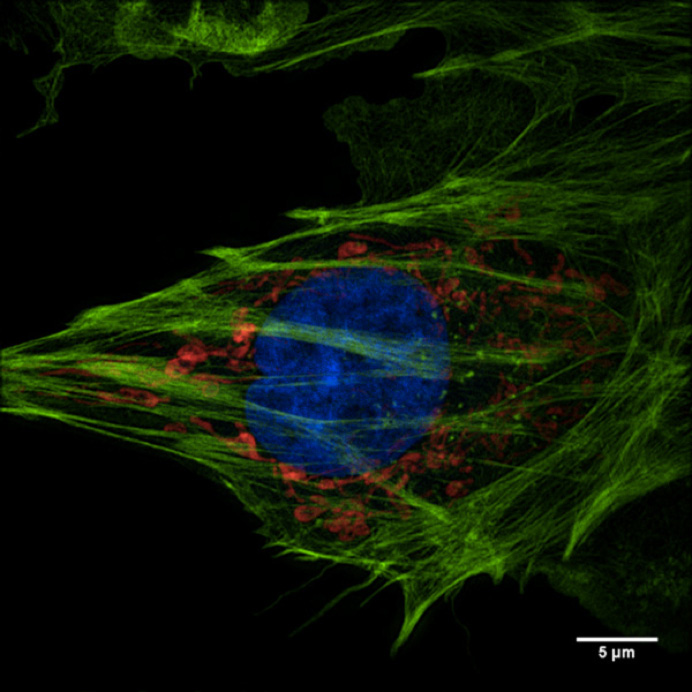 Super Resolution Microscopy (SIM)_images-3.jpg