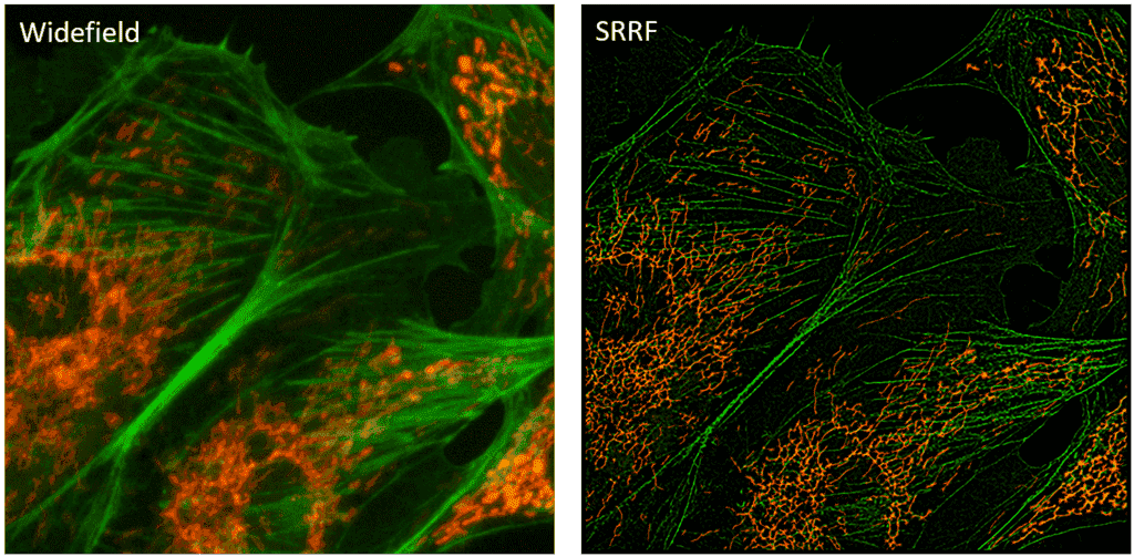 Super-Resolution Radial Fluctuations (SRRF)_image_1.png