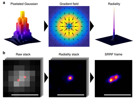 Super-Resolution Radial Fluctuations (SRRF)_image_3.png