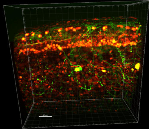 Super Resolution Spinning Disk Confocal Microscopy image-1.png