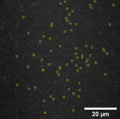 TIRF Microscopy-images-2 (2).png