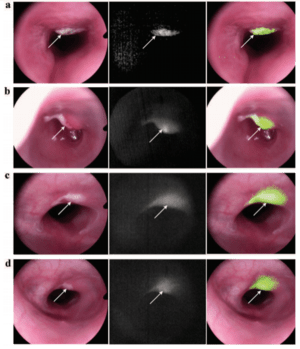 In Vivo Fluorescence Imaging-2.png