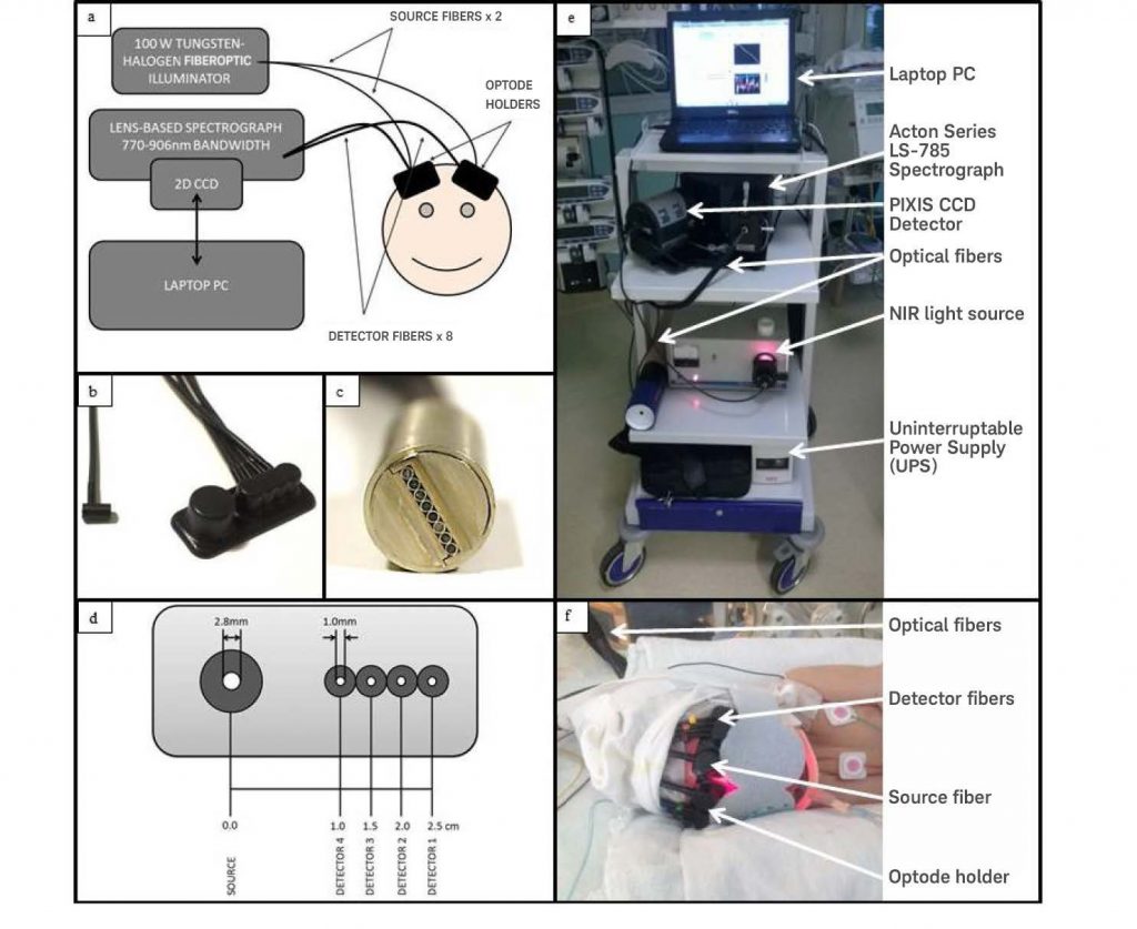 Application-Note-NIR-Spectroscopy-Aids-in-the-Diagnosis-of-Neonatal-1-1024x837.jpg