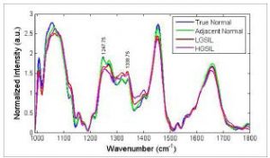 AppNote_Raman-Spectroscopy-to-Detect-Malignant-Changes-3-300x176.jpg