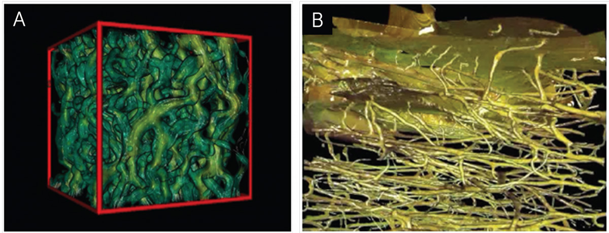 MCT-fig1-2-sim-fluid-streamlines-human-cortical-bone-1536x589.jpg